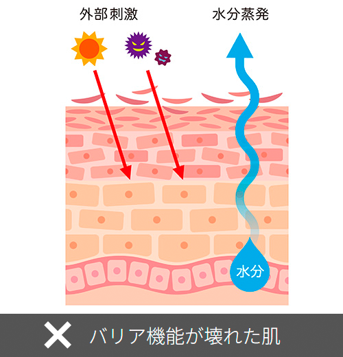 バリア機能が壊れた肌